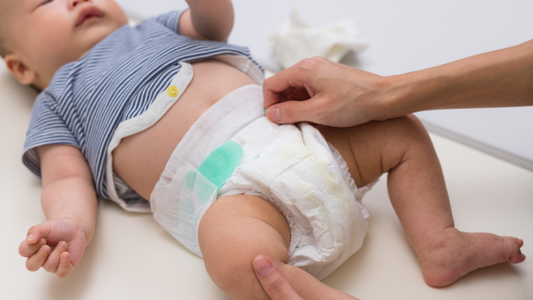 Si Kecil Sering Gelisah Saat Tidur? Cek Dulu, Siapa Tahu Ada Ruam Popok!